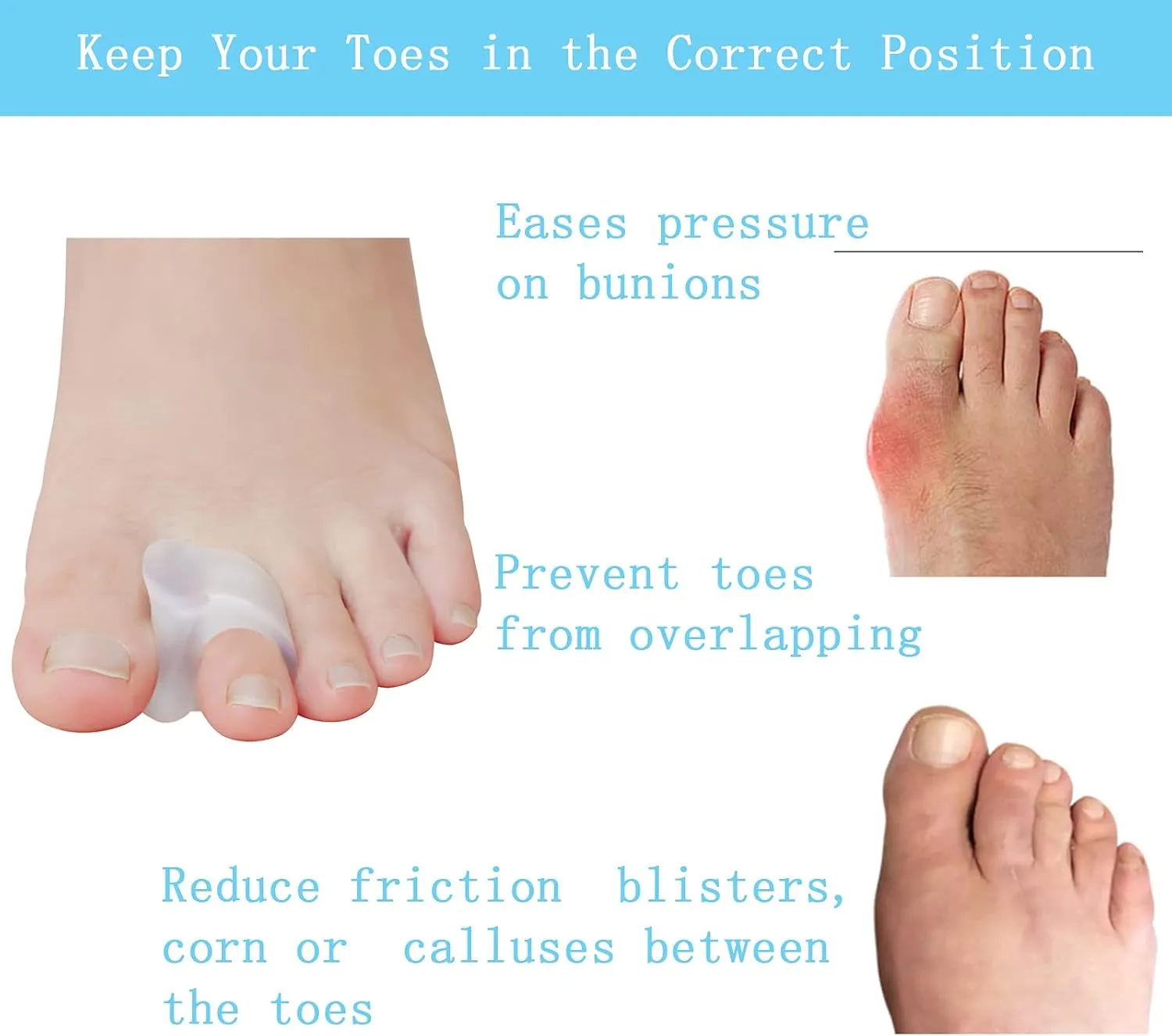 Pack of 12 Gel Toe Separator, (1/4" Thick) Big Toe Spacers, Single Loop Toe Spreader for Bunions, Overlapping Toe, Corrector and Spacer (Clear)